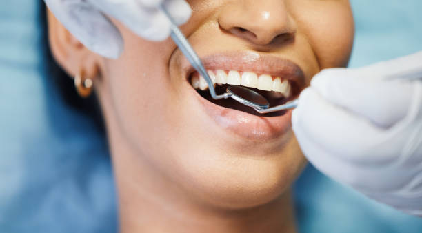Best Emergency Dentist for Lost Fillings or Crowns in Bowling Green, MD
